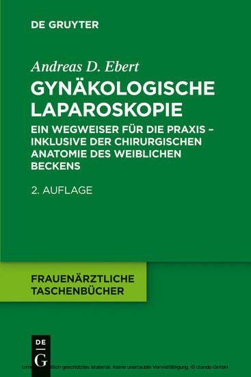 Gynäkologische Laparoskopie main product photo