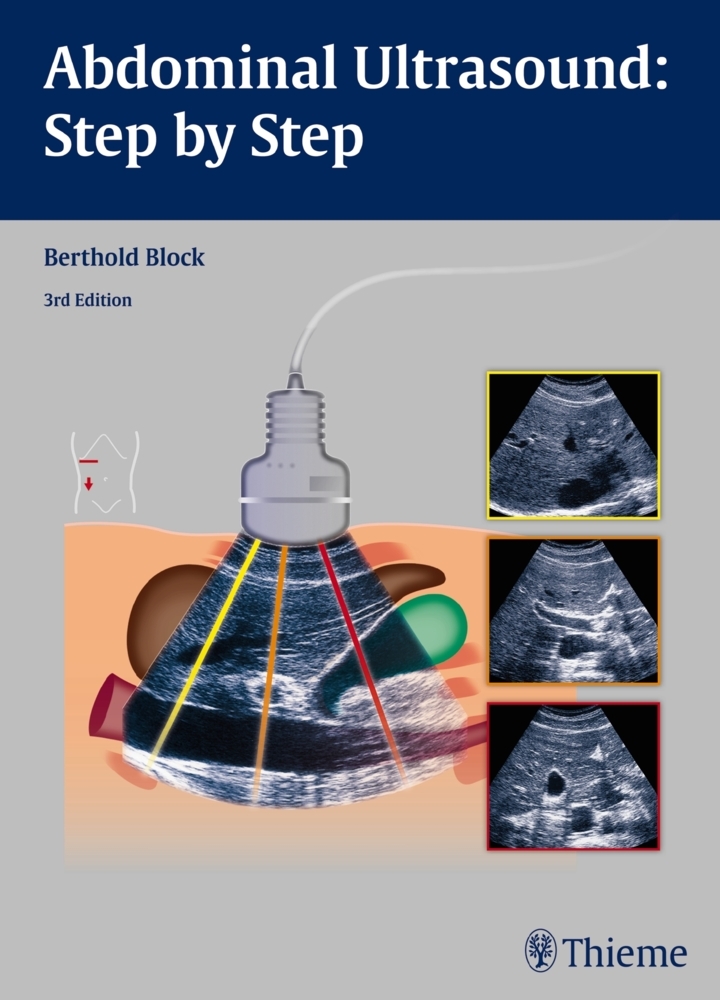 Abdominal Ultrasound: Step by Step main product photo