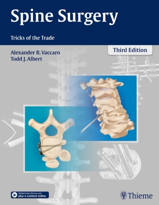 Spine Surgery
