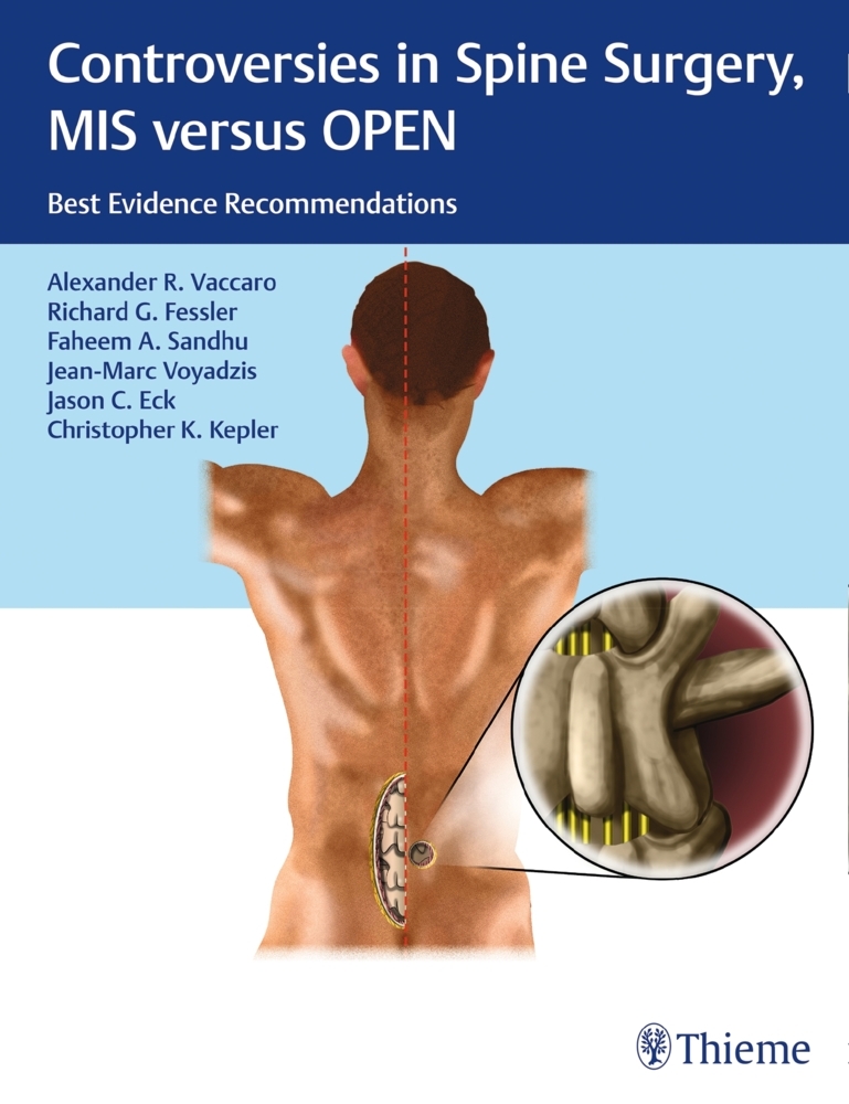Controversies in Spine Surgery: MIS versus OPEN main product photo