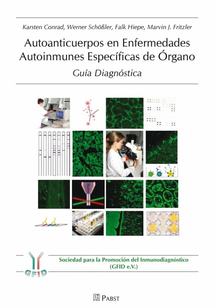 Autoanticuerpos en Enfermedades Autoinmunes Específicas de Órgano - Guía Diagnóstica main product photo
