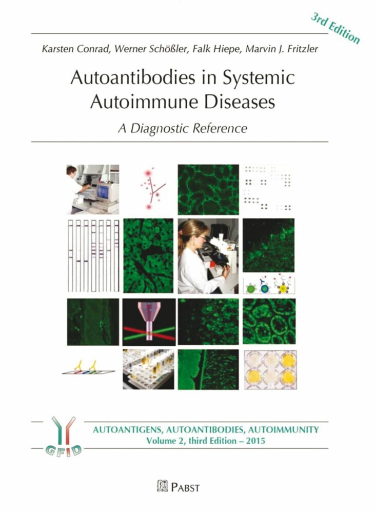 Autoantibodies in Systemic Autoimmune Diseases main product photo