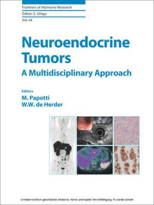 Neuroendocrine Tumors: A Multidisciplinary Approach