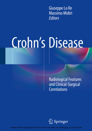 Crohn's Disease