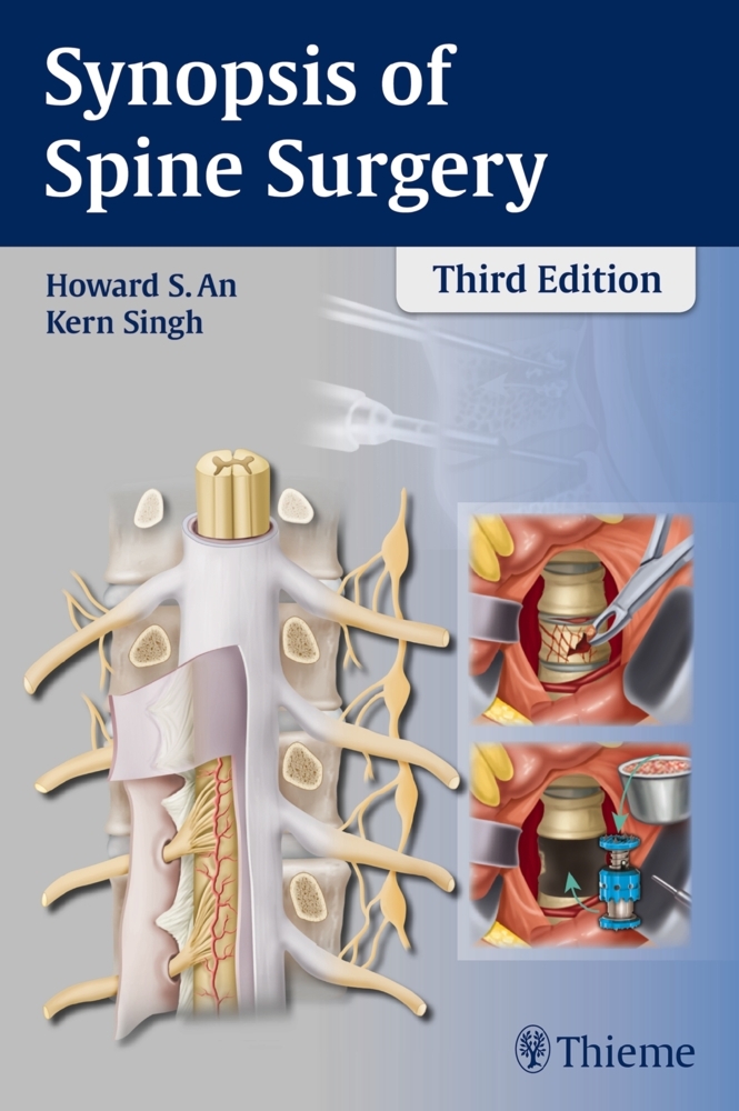 Synopsis of Spine Surgery main product photo