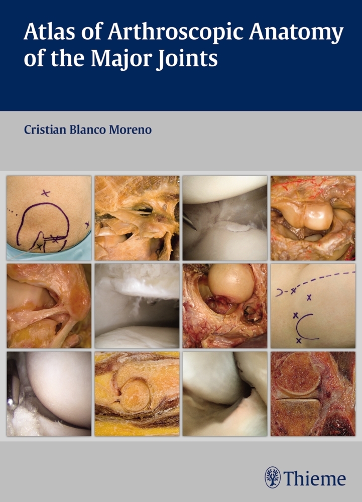 Atlas of Arthroscopic Anatomy of the Major Joints main product photo