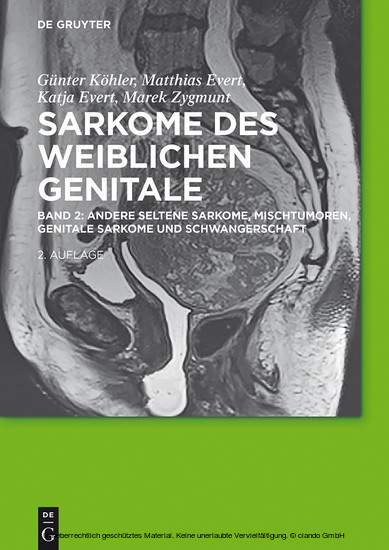 Andere seltene Sarkome, Mischtumoren, genitale Sarkome und Schwangerschaft main product photo