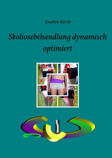 Skoliosebehandlung dynamisch optimiert main product photo