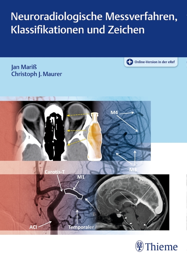 Neuroradiologische Messverfahren, Klassifikationen und Zeichen main product photo