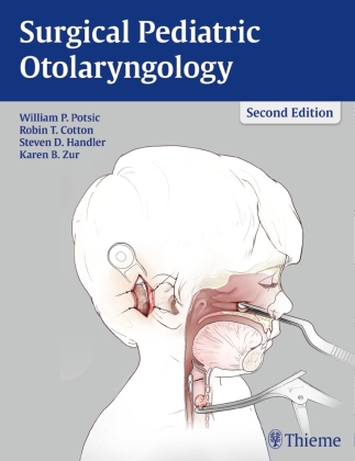 Surgical Pediatric Otolaryngology