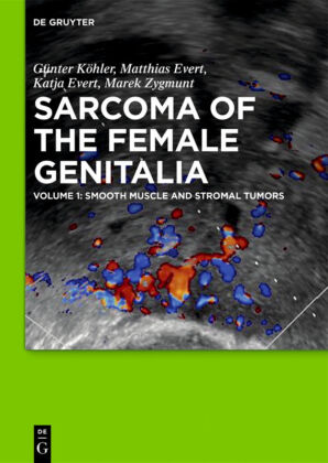 Smooth muscle and stromal tumors and prevention of inadequate surgery. Vol.1