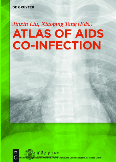 Atlas of AIDS Co-infection main product photo