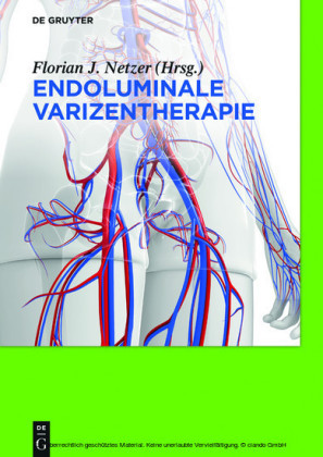 Endoluminale Varizentherapie
