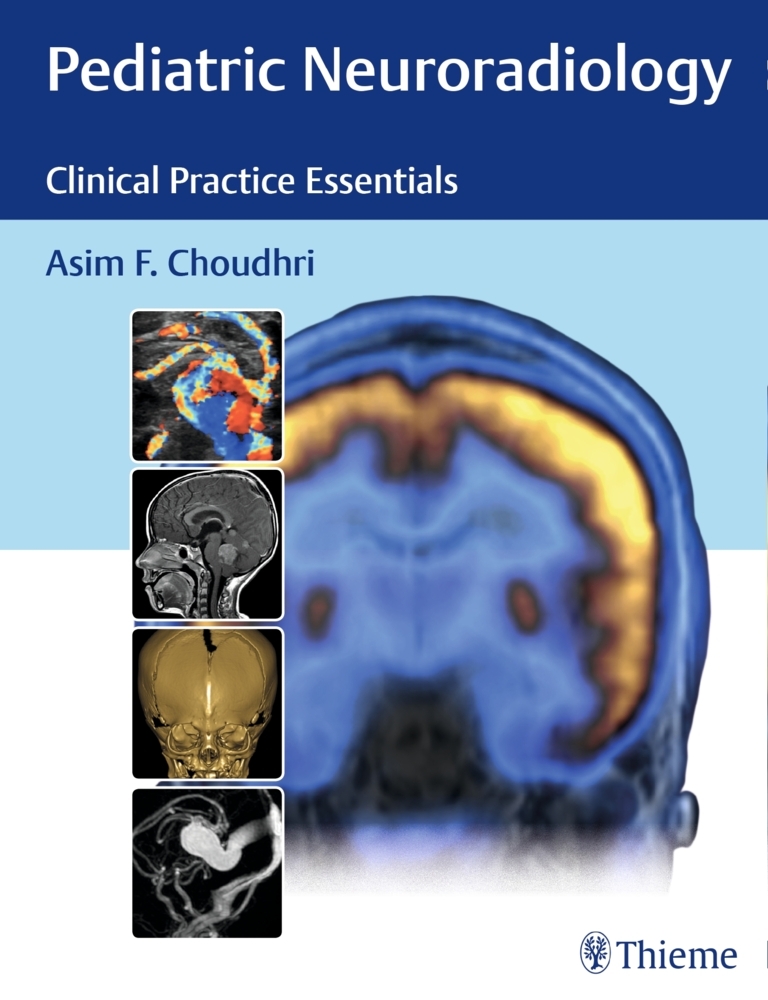 Pediatric Neuroradiology main product photo