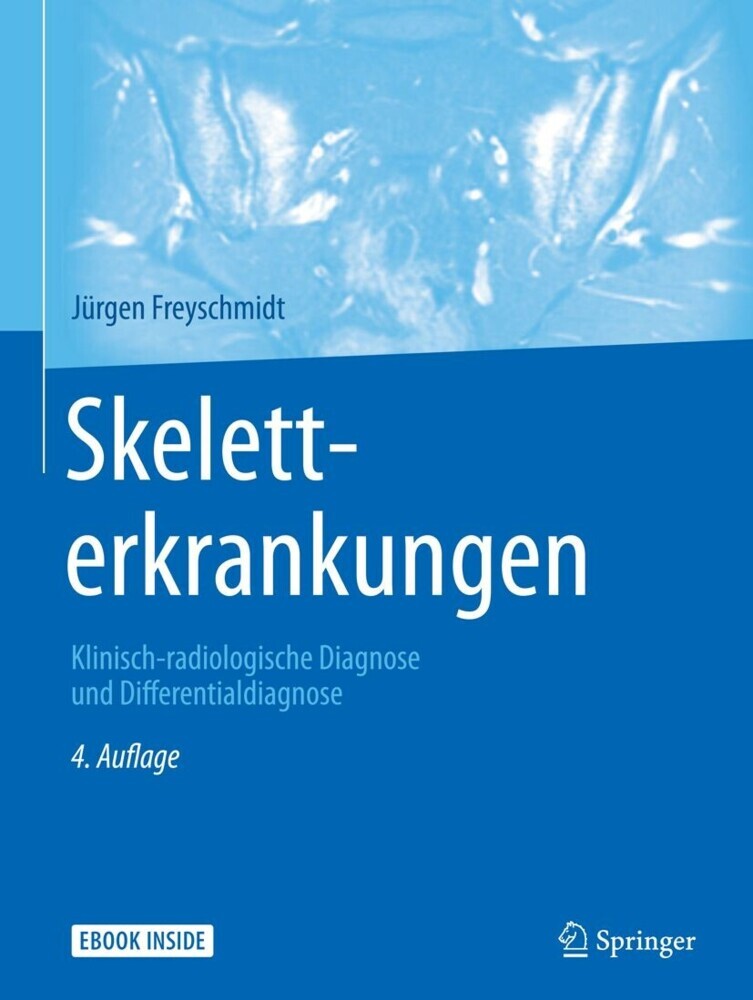 Skeletterkrankungen main product photo