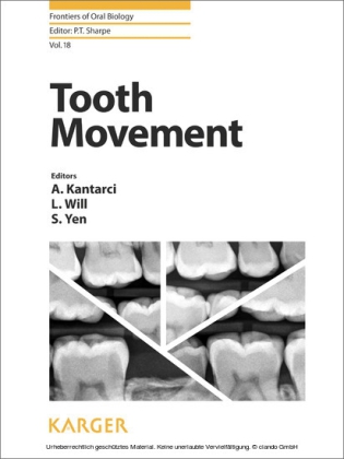 Tooth Movement