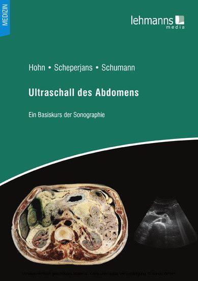 Ultraschall des Abdomens main product photo
