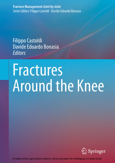 Fractures Around the Knee main product photo