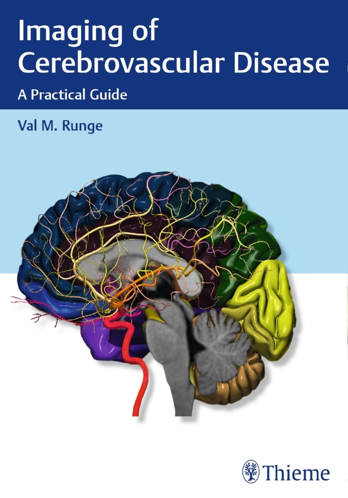 Imaging of Cerebrovascular Disease main product photo