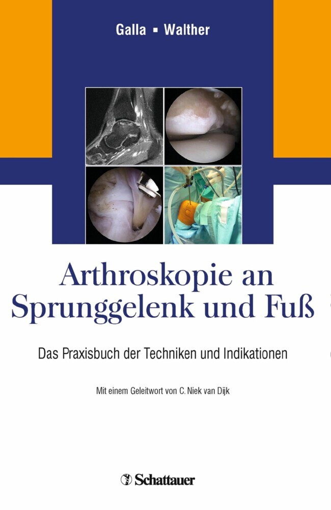 Arthroskopie an Sprunggelenk und Fuß main product photo