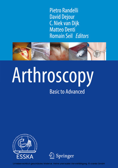 Arthroscopy main product photo