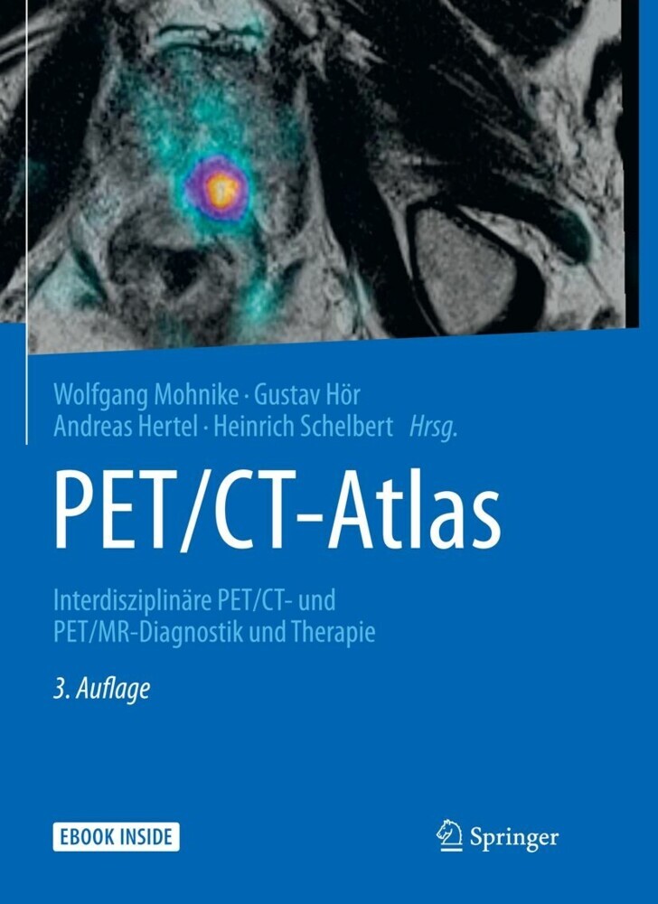 PET/CT-Atlas main product photo