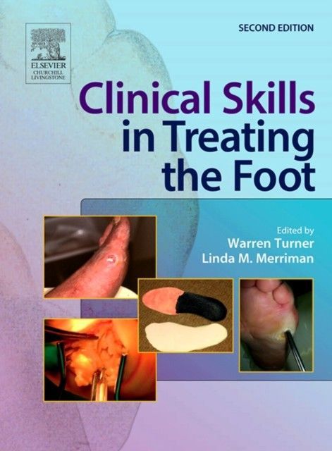 Clinical Skills in Treating the Foot main product photo
