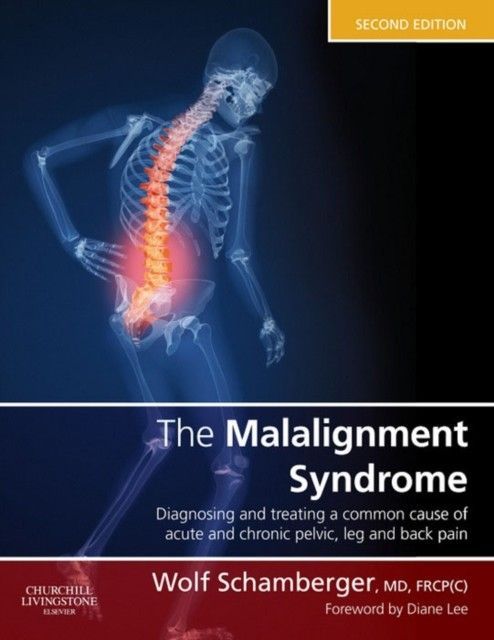 The Malalignment Syndrome main product photo