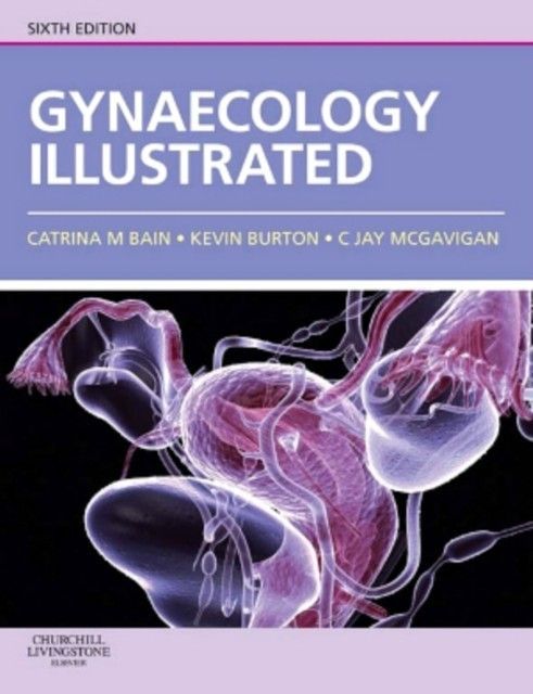 Gynaecology Illustrated main product photo