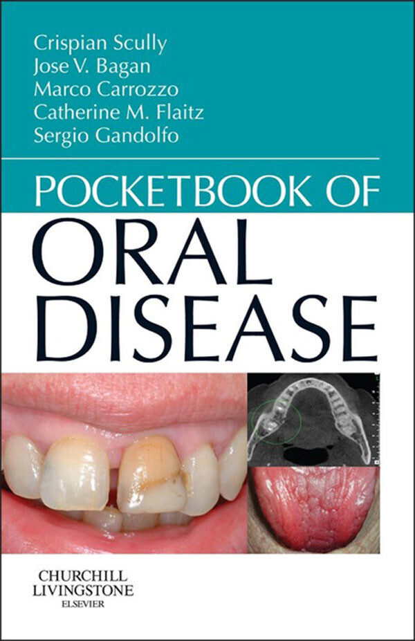 Pocketbook of Oral Disease - E-Book main product photo