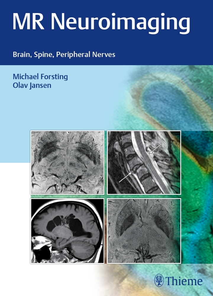 MR Neuroimaging main product photo