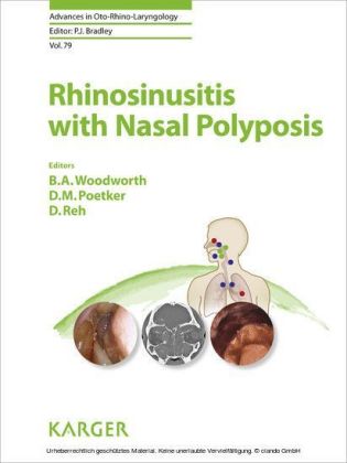 Rhinosinusitis with Nasal Polyposis