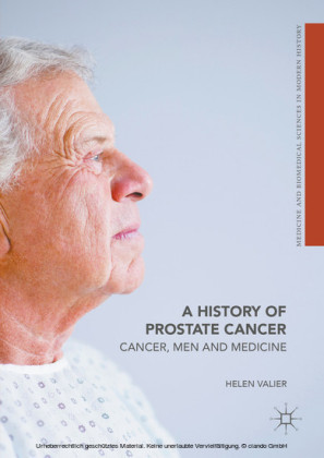 A History of Prostate Cancer