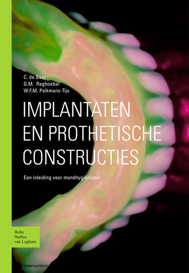 Implantaten en prothetische constructies main product photo
