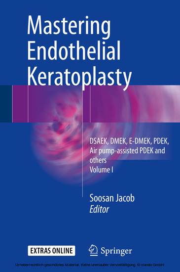 Mastering Endothelial Keratoplasty main product photo