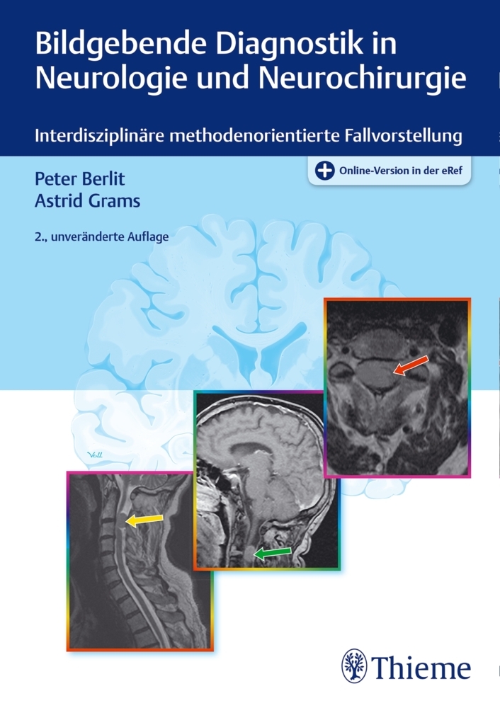 Bildgebende Diagnostik in Neurologie und Neurochirurgie main product photo
