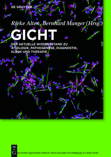 Gicht main product photo