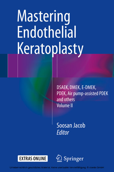 Mastering Endothelial Keratoplasty main product photo
