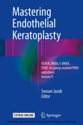 Mastering Endothelial Keratoplasty