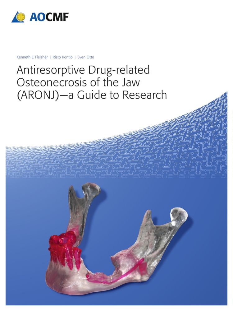 Antiresorptive Drug-Related Osteonecrosis of the Jaw (ARONJ) - A Guide to Research main product photo