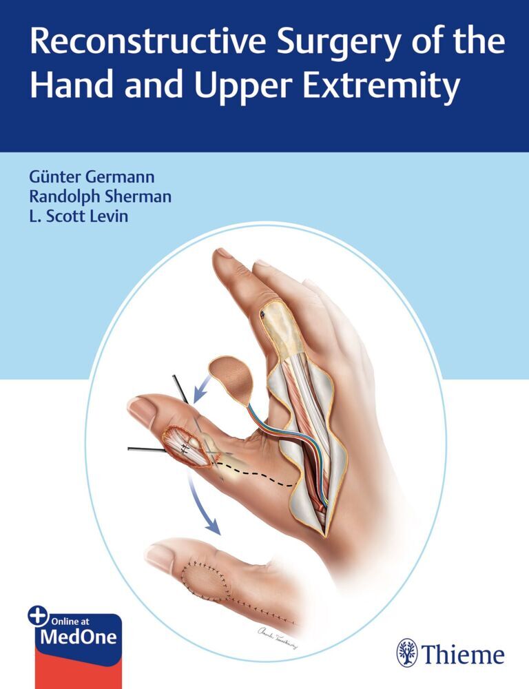 Reconstructive Surgery of the Hand and Upper Extremity main product photo