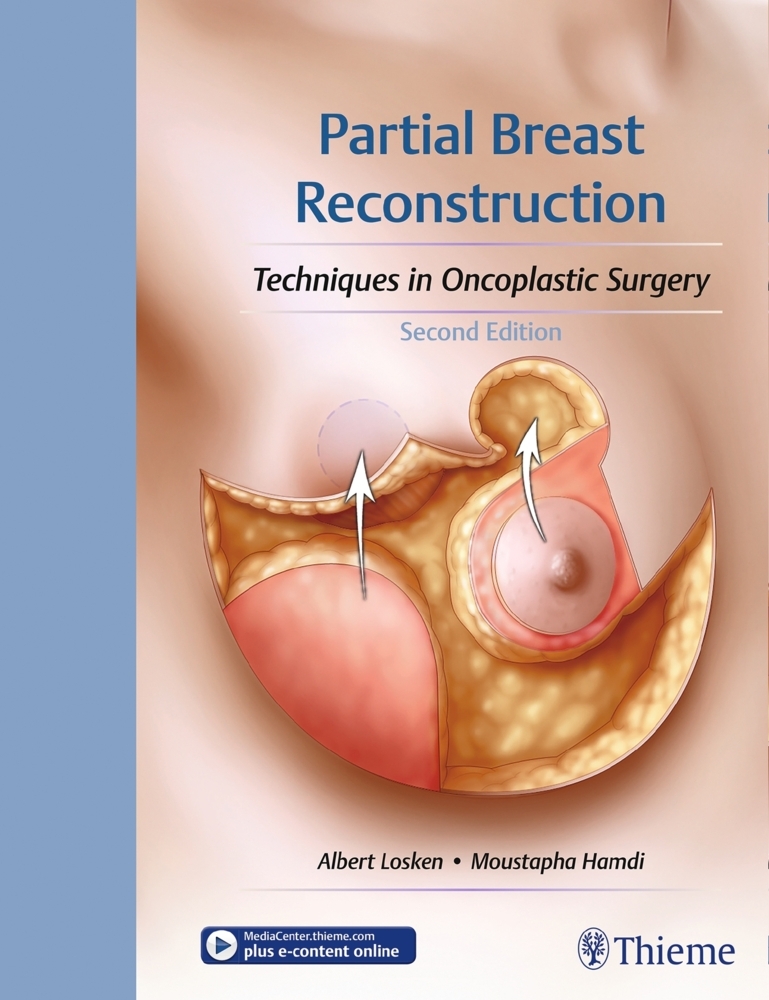 Partial Breast Reconstruction main product photo