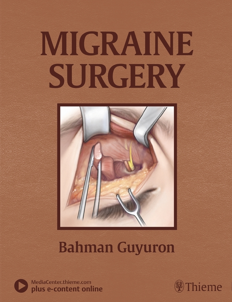 Migraine Surgery main product photo