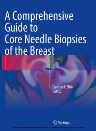 A Comprehensive Guide to Core Needle Biopsies of the Breast