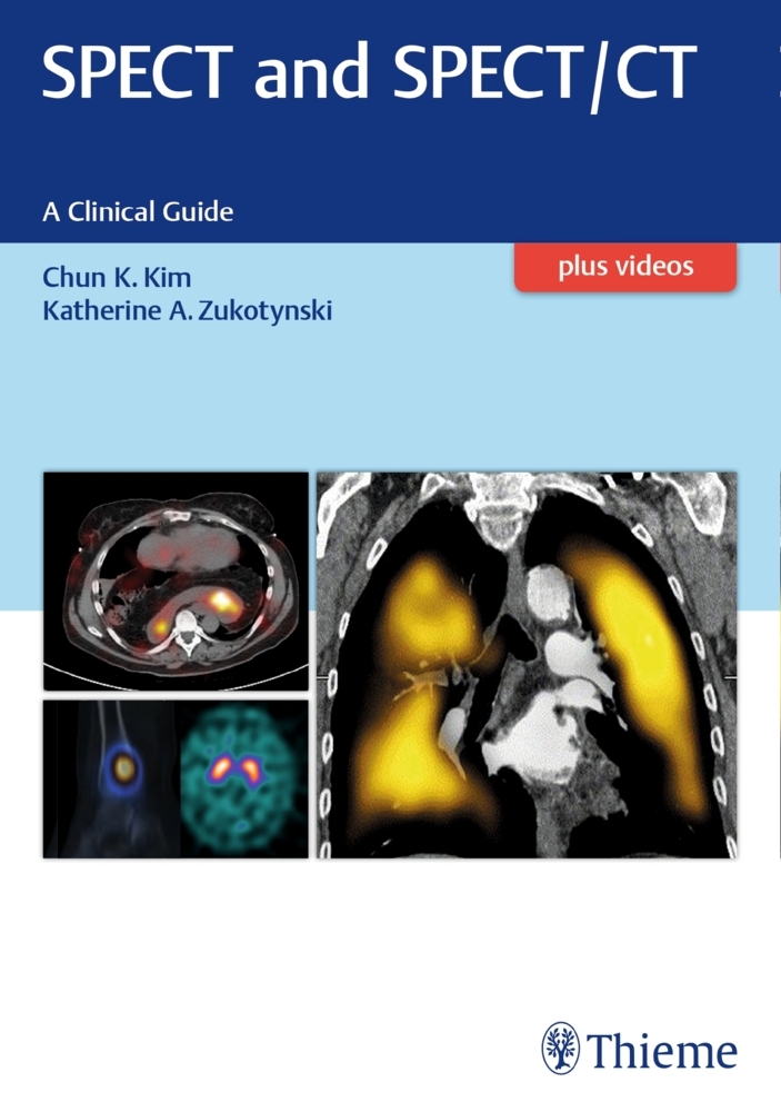 SPECT and SPECT/CT main product photo
