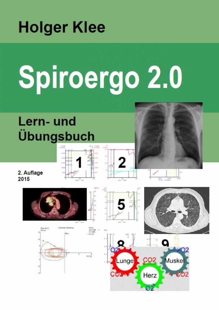 Spiroergo 2.0 main product photo