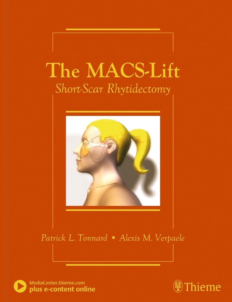 The MACS-Lift main product photo