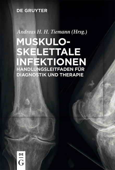 Muskuloskelettale Infektionen main product photo