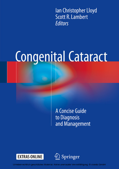 Congenital Cataract main product photo