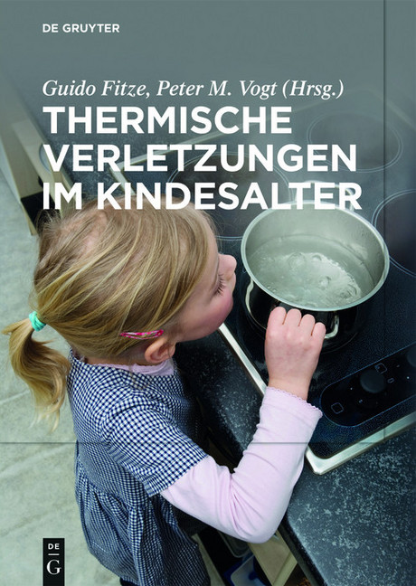 Thermische Verletzungen im Kindesalter main product photo